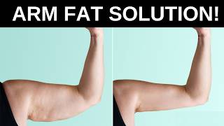 Get Rid of Flabby Arms  Best Exercise to Lose Arm Fat Fast 💪 [upl. by Annuhsal]