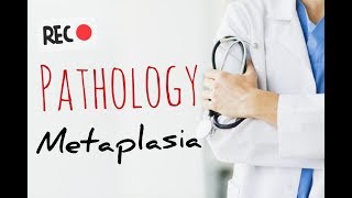 General pathology  metaplasia DRJAMALFARHAN123 [upl. by Johannah]