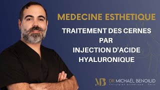 LE TRAITEMENT DES CERNES PAR INJECTION DACIDE HYALURONIQUE [upl. by Seuqram989]