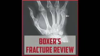 Boxer’s Fracture Treatment  Symptoms and Causes  Diagnosis  Prevention health [upl. by Armando]