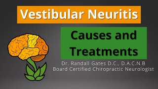 Vestibular Neuritis Causes and Treatment [upl. by Berriman]