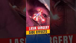 Side Effects Of Lasik Surgery [upl. by Euphemie]