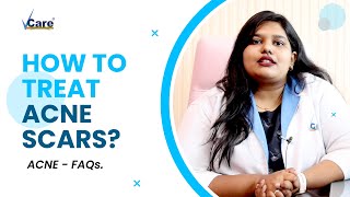 Best Treatment for Acne amp Acne Scars  Experts Answer  PART 2  VCare Hair amp Skin Clinics [upl. by Esila]