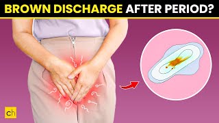 How To Stop Brown Discharge After Period  Causes amp Natural Remedies [upl. by Notterb118]