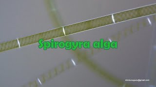 Spirogyra alga [upl. by Wainwright]