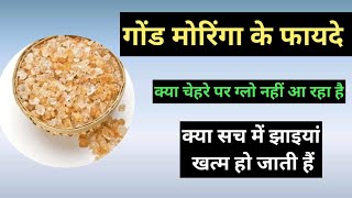 Gond moringa ke fayde । Pigmentation ko sahi karta hai kya। Zuhani Ayurveda [upl. by Sosthena]