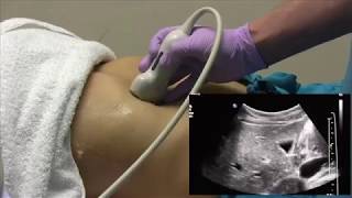 How I do it Ultrasound of the Abdomen [upl. by Inama]