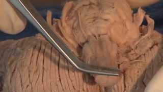 Cranial Nerves Neuroanatomy Video Lab  Brain Dissections [upl. by Manchester317]