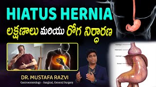 Hiatus Hernia EXPERT Reveals Shocking Symptoms  Dr Mustafa Surgical Gastroentrology [upl. by Smaoht]