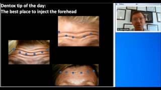 Botox Training  Injecting Forehead Properly  858 9055780 [upl. by Esej]