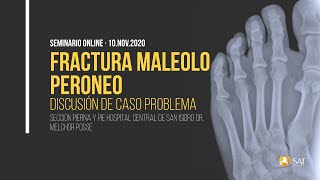 Fractura maleolo peroneo Discusión de caso  Webinar Lesiones Traumáticas en Tobillo y Pie [upl. by Shoshanna]