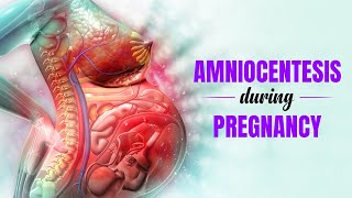 Amniocentesis during Pregnancy  What is it used for and its benefits  3D Guide [upl. by Alegnaed]