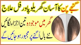 Hair Loss Treatment For Ganjapan Ka Gharelu Ilaj In Urdu [upl. by Frechette]