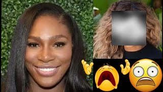 Serena Williams SHOCKING NEW FACE [upl. by Cleopatra966]