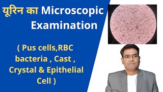 How To Do Microscopic Examination of Urine  Urine microscopy Explained  Pus cells  Rbc [upl. by Renie102]