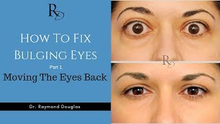 How To Fix Bulging Eyes  Part 1  Moving The Eyes Back [upl. by Alaek602]