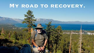 Esophageal Cancer Eds Story from Treatment to Recovery [upl. by Bevis]