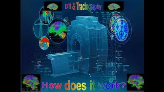 04 Brain DTI amp Tractography 1  Prof Dr Rania Essameldein Mohamed [upl. by Ruffo]