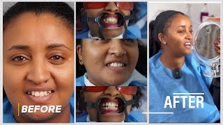 ማርታ ጎይቶም ጥርሷን አሰራች  Martha Goytom dental correction [upl. by Rosabelle]