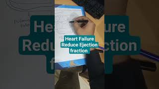 Heart failure reduced ejection fractionWhat is heart failure with reduce ejection fraction Intro [upl. by Eerat251]