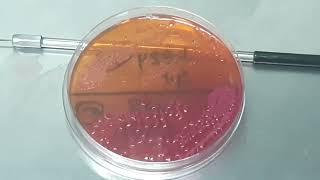 Stenotrophomonas maltophilia Gram staining Culture Characteristics and Wet mount Microscopy [upl. by Eelloh]