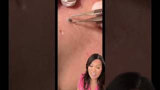 Some great blackheads and DPOWs on the back [upl. by Llennaj]