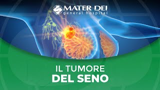 Il tumore del seno [upl. by Ttergram]