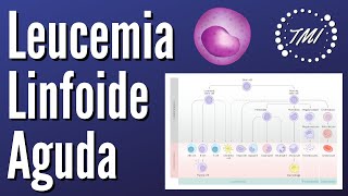 Leucemia Linfoide Aguda Explicada Claramente [upl. by Vinia630]