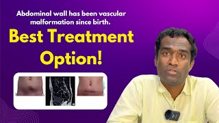 vascular malformation treatment in Hyderabad Dr Shaileshkumar at CitiVascularCentre  malformation [upl. by Basir]