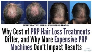 Factors of Differing Costs of PRP Hair Loss Treatments and Why Expensive PRP Machines are Unproven [upl. by Ysnil36]