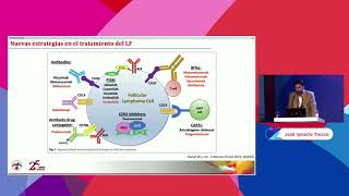 Linfomas Novedades en el tratamiento [upl. by Zoilla]