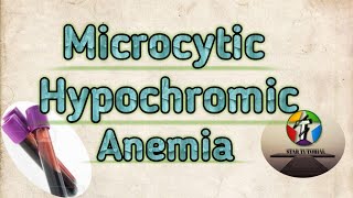 Microcytic Hypochromic Anemia in hindi ll ANEMIA ll Hematology And Blood Banking [upl. by Sander10]