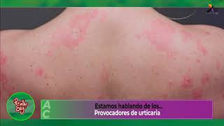 ¿Ronchas en la piel que pican Puede ser urticaria [upl. by Anyat]