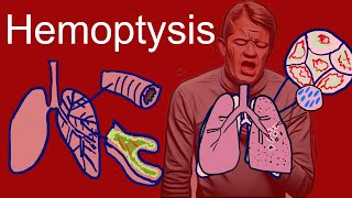 Hemoptysis Coughing Up Blood  Causes types symptoms [upl. by Oilla]