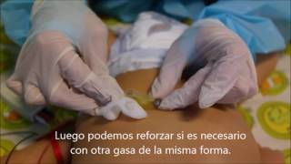 Curación de la gastrostomía  Clínica Indisa  UCEP [upl. by Enyrhtac]