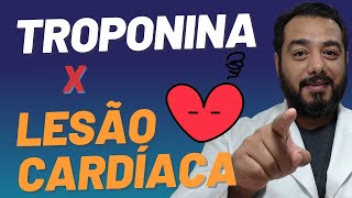 O que é troponina e por que seus níveis sanguíneos elevados indicam dano cardíaco  Victor Proença [upl. by Mellitz]