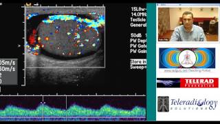 Ultrasound of Acute Epididymo Orchitis by Dr Arjun Kalyanpur [upl. by Negah169]