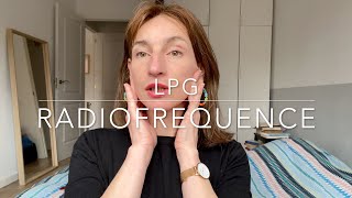 RESULTAT APRES 5 SEANCES LPG ET RADIOFREQUENCE UNE PEAU RESPLENDISSANTE [upl. by Berga600]