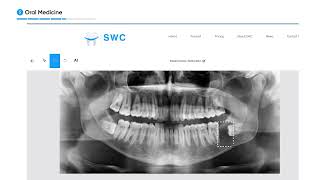 Intelligent Report  AI Reporting For All Dental Cases [upl. by Genet86]