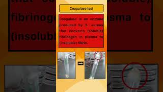 Coagulase test [upl. by Barsky]