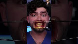 Gold teeth with golden toothpaste 🦷 yt viral ytshorts argal [upl. by Ardnuek]