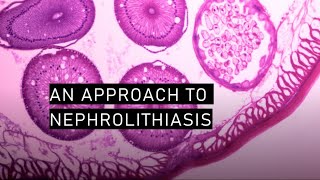 An approach to nephrolithiasis [upl. by Armando]