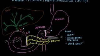 Whipple Procedure Pancreaticoduodenectomy [upl. by Marcello]