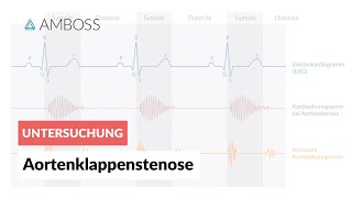 Aortenklappenstenose  Herzgeräusch  AMBOSS Video [upl. by Yanel80]