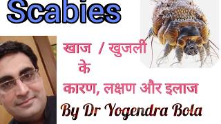 SCABIES COMPLETE CURE and treatment by DR YOGENDRA BOLA in hindiरात को होने वाली खुजली का इलाज [upl. by Mcdougall120]