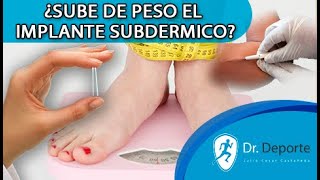 IMPLANTE SUBDÉRMICO SUBE DE PESO VENTAJAS Y DESVENTAJAS ANÁLISIS MÉDICO [upl. by Arebma]