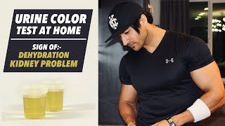 Urine Color Test  Sign of Dehydration amp Kidney Problem  Important info by Guru Mann [upl. by Neeluj]