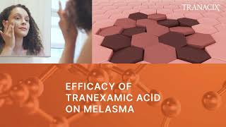 TREATMENT OF MELASMA  TRANACIX® Cream  Medical Spot [upl. by Ydde]