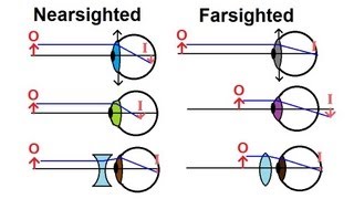 Physics  Optics Vision Correction 1 of 5 Introduction [upl. by Corie180]