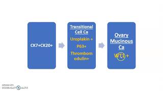 Approach to metastatic Carcinoma of unknown primary [upl. by Lleryd]